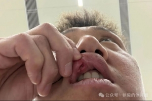 高迪赛后共缝九针：昨天蛮疼今天又是一条好汉，不想错过踢申花