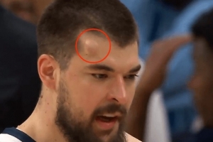 “头上有犄角！”祖巴茨防守时被克林根打出包 回更衣室&回归成疑